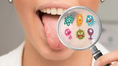 Oral