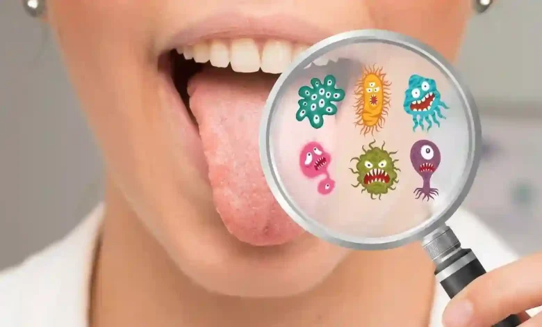 Oral